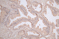 IHC image of CSB-RA005728MA1HU diluted at 1:50 and staining in paraffin-embedded human prostate cancer performed on a Leica BondTM system. After dewaxing and hydration, antigen retrieval was mediated by high pressure in a citrate buffer (pH 6.0) . Section was blocked with 10% normal goat serum 30min at RT. Then primary antibody (1% BSA) was incubated at 4°C overnight. The primary is detected by a Goat anti-Mouse IgG labeled by HRP and visualized using 0.05% DAB.
