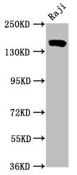 Western Blot
Positive WB detected in Raji whole cell lysate
All lanes CD21 antibody at 0.55μg/ml
Secondary
Goat polyclonal to rabbit IgG at 1/50000 dilution
Predicted band size: 155 KDa
Observed band size: 155 KDa