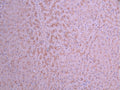 IHC image of CSB-RA005991MA1HU diluted at 1:50 and staining in paraffin-embedded human liver tissue performed on a Leica BondTM system. After dewaxing and hydration, antigen retrieval was mediated by high pressure in a citrate buffer (pH 6.0) . Section was blocked with 10% normal goat serum 30min at RT. Then primary antibody (1% BSA) was incubated at 4°C overnight. The primary is detected by a Anti-Human lgG, Fcy Fragment Specific labeled by HRP and visualized using 0.05% DAB.