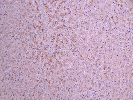 IHC image of CSB-RA005991MA1HU diluted at 1:50 and staining in paraffin-embedded human liver tissue performed on a Leica BondTM system. After dewaxing and hydration, antigen retrieval was mediated by high pressure in a citrate buffer (pH 6.0) . Section was blocked with 10% normal goat serum 30min at RT. Then primary antibody (1% BSA) was incubated at 4°C overnight. The primary is detected by a Anti-Human lgG, Fcy Fragment Specific labeled by HRP and visualized using 0.05% DAB.