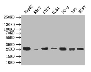 Western Blot
Positive WB detected in: HepG2 whole cell lysate, K562 whole cell lysate, SY5Y whole cell lysate, U251 whole cell lysate, PC-3 whole cell lysate, 293 whole cell lysate, MCF7 whole cell lysate
All lanes: CTLA4 antibody at 1:500
Secondary
Goat polyclonal to mouse IgG at 1/50000 dilution
Predicted band size: 25 kDa
Observed band size: 25 kDa