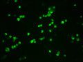 Immunofluorescence staining of 293T cells(treated with 50nM Calyculin A for 30min) with CSB-RA006169A33phHU at 1:100,counter-stained with DAPI. The cells were fixed in 4% formaldehyde, permeabilized using 0.2% Triton X-100 and blocked in 10% normal Goat Serum. The cells were then incubated with the antibody overnight at 4℃. The secondary antibody was Alexa Fluor 488-congugated AffiniPure Goat Anti-Rabbit IgG (H+L) .