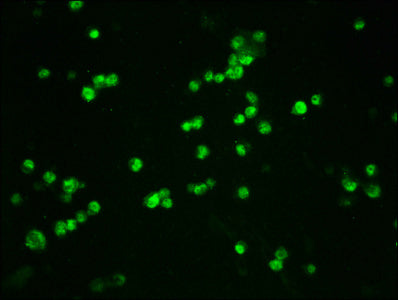 Immunofluorescence staining of 293T cells(treated with 50nM Calyculin A for 30min) with CSB-RA006169A33phHU at 1:100,counter-stained with DAPI. The cells were fixed in 4% formaldehyde, permeabilized using 0.2% Triton X-100 and blocked in 10% normal Goat Serum. The cells were then incubated with the antibody overnight at 4℃. The secondary antibody was Alexa Fluor 488-congugated AffiniPure Goat Anti-Rabbit IgG (H+L) .