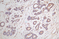 IHC image of CSB-RA006169MA1HU diluted at 1:100 and staining in paraffin-embedded human breast tissue performed on a Leica BondTM system. After dewaxing and hydration,  antigen retrieval was mediated by high pressure in a citrate buffer (pH 6.0) . Section was blocked with 10% normal goat serum 30min at RT. Then primary antibody (1% BSA) was incubated at 4°C overnight. The primary is detected by a Goat anti-rabbit polymer IgG labeled by HRP and visualized using 0.05% DAB.