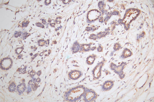 IHC image of CSB-RA006169MA1HU diluted at 1:100 and staining in paraffin-embedded human breast tissue performed on a Leica BondTM system. After dewaxing and hydration,  antigen retrieval was mediated by high pressure in a citrate buffer (pH 6.0) . Section was blocked with 10% normal goat serum 30min at RT. Then primary antibody (1% BSA) was incubated at 4°C overnight. The primary is detected by a Goat anti-rabbit polymer IgG labeled by HRP and visualized using 0.05% DAB.