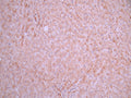 IHC image of CSB-RA006243MA1HU diluted at 1:50 and staining in paraffin-embedded human liver tissue performed on a Leica BondTM system. After dewaxing and hydration, antigen retrieval was mediated by high pressure in a citrate buffer (pH 6.0). Section was blocked with 10% normal goat serum 30min at RT. Then primary antibody (1% BSA) was incubated at 4°C overnight. The primary is detected by a Anti-Human lgG, Fcy Fragment Specific labeled by HRP and visualized using 0.05% DAB.