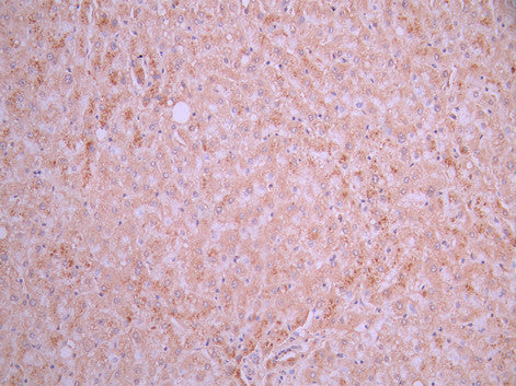 IHC image of CSB-RA006243MA1HU diluted at 1:50 and staining in paraffin-embedded human liver tissue performed on a Leica BondTM system. After dewaxing and hydration, antigen retrieval was mediated by high pressure in a citrate buffer (pH 6.0). Section was blocked with 10% normal goat serum 30min at RT. Then primary antibody (1% BSA) was incubated at 4°C overnight. The primary is detected by a Anti-Human lgG, Fcy Fragment Specific labeled by HRP and visualized using 0.05% DAB.