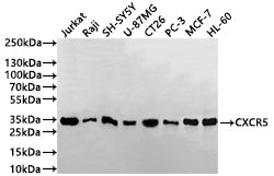 Western Blot
Positive WB detected in: Jurkat whole cell lysate(30µg), Raji whole cell lysate(30µg), SH-SY5Y whole cell lysate(30µg), U-87MG whole cell lysate(30µg), CT26 whole cell lysate(30µg), PC-3 whole cell lysate(30µg), MCF-7 whole cell lysate(30µg), HL-60 whole cell lysate(30µg)
All lanes: CXCR5 antibody at 1:1000
Secondary
Goat polyclonal to human IgG at 1/40000 dilution
Predicted band size: 42 kDa
Observed band size: 33 kDa
Exposure time: 2min