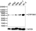 Western Blot
Positive WB detected in: 293 whole cell lysate(20µg) , K562 whole cell lysate(20µg) ,  Hela whole cell lysate(20µg) , MCF-7 whole cell lysate(20µg) , PC-3 whole cell lysate(20µg) 
All lanes: CYP19A1 antibody at 1:1000
Secondary
Goat polyclonal to rabbit IgG at 1/50000 dilution
Predicted band size: 58 kDa
Observed band size: 58 kDa
Exposure time：120s