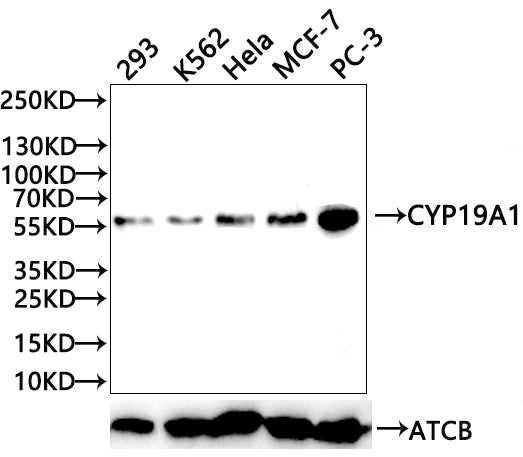 Western Blot
Positive WB detected in: 293 whole cell lysate(20µg) , K562 whole cell lysate(20µg) ,  Hela whole cell lysate(20µg) , MCF-7 whole cell lysate(20µg) , PC-3 whole cell lysate(20µg) 
All lanes: CYP19A1 antibody at 1:1000
Secondary
Goat polyclonal to rabbit IgG at 1/50000 dilution
Predicted band size: 58 kDa
Observed band size: 58 kDa
Exposure time：120s