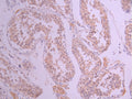 IHC image of CSB-RA006576MA1HU diluted at 1:50 and staining in paraffin-embedded human testis tissue performed on a Leica BondTM system. After dewaxing and hydration, antigen retrieval was mediated by high pressure in a citrate buffer (pH 6.0). Section was blocked with 10% normal goat serum 30min at RT. Then primary antibody (1% BSA) was incubated at 4°C overnight. The primary is detected by a Anti-Human lgG, Fcy Fragment Specific labeled by HRP and visualized using 0.05% DAB.