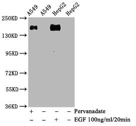 Western Blot
Positive WB detected in A549 whole cell lysate, HepG2 whole cell lysate(treated with EGF or Pervanadate) 
All lanes Phospho-EGFR antibody at 1.28μg/ml
Secondary
Goat polyclonal to rabbit IgG at 1/50000 dilution
Predicted band size: 175 KDa
Observed band size: 175 KDa