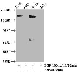 Western Blot
Positive WB detected in A549 whole cell lysate,Hela whole cell lysate(treated with Pervanadate or EGF) 
All lanes Phospho-EGFR antibody at 1.35μg/ml
Secondary
Goat polyclonal to rabbit IgG at 1/50000 dilution
Predicted band size: 170 KDa
Observed band size: 170 KDa
