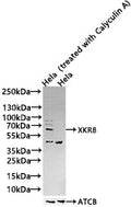 Western Blot
Positive WB detected in Hela whole cell lysate(treated with Calyculin A or not) 
All lanes Phospho-EIF2AK2 antibody at 1.25μg/ml
Secondary
Goat polyclonal to rabbit IgG at 1/50000 dilution
Predicted band size: 62 KDa
Observed band size: 62 KDa