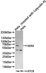 Western Blot
Positive WB detected in Hela whole cell lysate(treated with Calyculin A or not) 
All lanes Phospho-EIF2AK2 antibody at 1.25μg/ml
Secondary
Goat polyclonal to rabbit IgG at 1/50000 dilution
Predicted band size: 62 KDa
Observed band size: 62 KDa