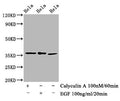 Western Blot
Positive WB detected in Hela whole cell lysate(treated with Calyculin A or EGF) 
All lanes Phospho-EIF2S1 antibody at 1.48μg/ml
Secondary
Goat polyclonal to rabbit IgG at 1/50000 dilution
Predicted band size: 36 KDa
Observed band size: 36 KDa