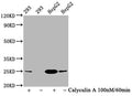 Western Blot
Positive WB detected in 293 whole cell lysate,HepG2 whole cell lysate(treated with Calyculin A or not) 
All lanes Phospho-EIF4E antibody at 1.2μg/ml
Secondary
Goat polyclonal to rabbit IgG at 1/50000 dilution
Predicted band size: 25 KDa
Observed band size: 25 KDa