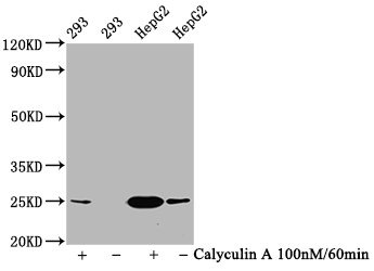 Western Blot
Positive WB detected in 293 whole cell lysate,HepG2 whole cell lysate(treated with Calyculin A or not) 
All lanes Phospho-EIF4E antibody at 1.2μg/ml
Secondary
Goat polyclonal to rabbit IgG at 1/50000 dilution
Predicted band size: 25 KDa
Observed band size: 25 KDa