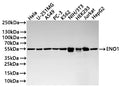 Western Blot
Positive WB detected in: HeLa whole cell lysate(20µg) , U-251MG whole cell lysate(20µg) , A549 whole cell lysate(20µg) , PC-3 whole cell lysate(20µg) , K562 whole cell lysate(20µg) , NIH/3T3 whole cell lysate(20µg) , HEK293 whole cell lysate(20µg) , Jurkat whole cell lysate(20µg) , HepG2 whole cell lysate(20µg) 
All lanes: ENO1 antibody at 1:1000
Secondary
Goat polyclonal to human IgG at 1/40000 dilution
Predicted band size: 47 kDa
Observed band size: 55 kDa
Exposure time：5s