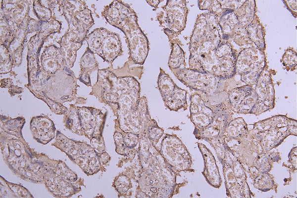 IHC image of CSB-RA007690MA1HU diluted at 1:100 and staining in paraffin-embedded human placenta tissue performed on a Leica BondTM system. After dewaxing and hydration, antigen retrieval was mediated by high pressure in a citrate buffer (pH 6.0) . Section was blocked with 10% normal goat serum 30min at RT. Then primary antibody (1% BSA) was incubated at 4°C overnight. The primary is detected by a Goat anti-Human IgG labeled by HRP and visualized using 0.05% DAB.