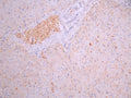 IHC image of CSB-RA007743MA1HU diluted at 1:50 and staining in paraffin-embedded human liver tissue performed on a Leica BondTM system. After dewaxing and hydration, antigen retrieval was mediated by high pressure in a citrate buffer (pH 6.0). Section was blocked with 10% normal goat serum 30min at RT. Then primary antibody (1% BSA) was incubated at 4°C overnight. The primary is detected by a Anti-Human lgG, Fcy Fragment Specific labeled by HRP and visualized using 0.05% DAB.
