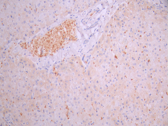 IHC image of CSB-RA007743MA1HU diluted at 1:50 and staining in paraffin-embedded human liver tissue performed on a Leica BondTM system. After dewaxing and hydration, antigen retrieval was mediated by high pressure in a citrate buffer (pH 6.0). Section was blocked with 10% normal goat serum 30min at RT. Then primary antibody (1% BSA) was incubated at 4°C overnight. The primary is detected by a Anti-Human lgG, Fcy Fragment Specific labeled by HRP and visualized using 0.05% DAB.