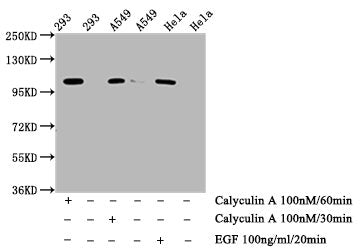 Phospho-ERN1 (S724) Antibody – Figure 1 of 2