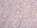 IHC image of CSB-RA008545MA1HU diluted at 1:150 and staining in paraffin-embedded human lung tissue performed on a Leica BondTM system. After dewaxing and hydration, antigen retrieval was mediated by high pressure in a citrate buffer (pH 6.0) . Section was blocked with 10% normal goat serum 30min at RT. Then primary antibody (1% BSA) was incubated at 4°C overnight. The primary is detected by a Goat anti-human polymer IgG labeled by HRP and visualized using 0.05% DAB.