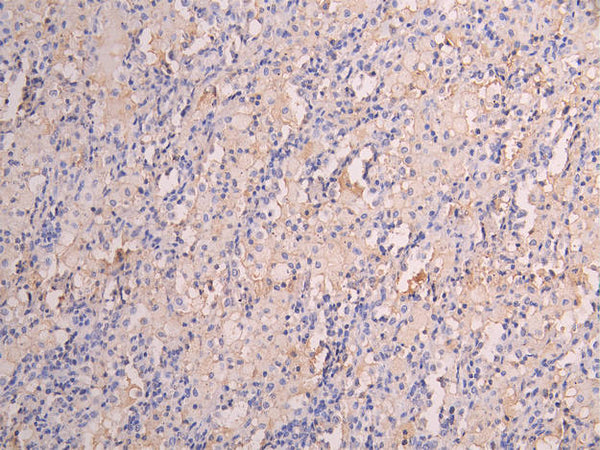 IHC image of CSB-RA008545MA1HU diluted at 1:150 and staining in paraffin-embedded human lung tissue performed on a Leica BondTM system. After dewaxing and hydration, antigen retrieval was mediated by high pressure in a citrate buffer (pH 6.0) . Section was blocked with 10% normal goat serum 30min at RT. Then primary antibody (1% BSA) was incubated at 4°C overnight. The primary is detected by a Goat anti-human polymer IgG labeled by HRP and visualized using 0.05% DAB.