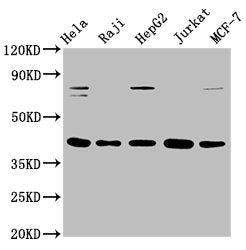 Western Blot
Positive WB detected in: Hela whole cell lysate, Raji whole cell lysate, HepG2 whole cell lysate, Jurkat whole cell lysate, MCF-7 whole cell lysate
All lanes: FEN1 antibody at 0.775μg/ml
Secondary
Goat polyclonal to rabbit IgG at 1/50000 dilution
Predicted band size: 43, 36 KDa
Observed band size: 43 KDa