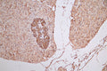 IHC image of CSB-RA008642MA1HU diluted at 1:100 and staining in paraffin-embedded human pancreatic tissue performed on a Leica BondTM system. After dewaxing and hydration,  antigen retrieval was mediated by high pressure in a citrate buffer (pH 6.0) . Section was blocked with 10% normal goat serum 30min at RT. Then primary antibody (1% BSA) was incubated at 4°C overnight. The primary is detected by a Goat anti-Rabbit IgG labeled by HRP and visualized using 0.05% DAB.
