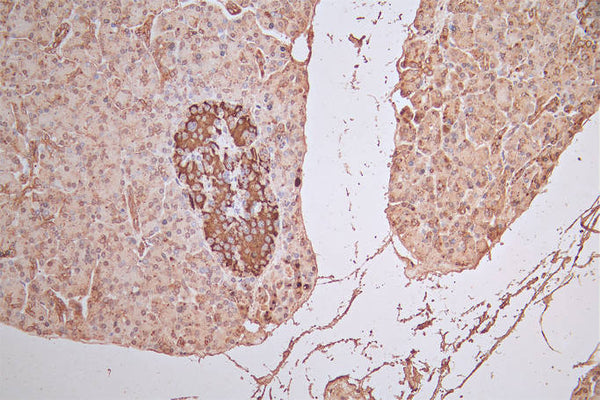 IHC image of CSB-RA008642MA1HU diluted at 1:100 and staining in paraffin-embedded human pancreatic tissue performed on a Leica BondTM system. After dewaxing and hydration,  antigen retrieval was mediated by high pressure in a citrate buffer (pH 6.0) . Section was blocked with 10% normal goat serum 30min at RT. Then primary antibody (1% BSA) was incubated at 4°C overnight. The primary is detected by a Goat anti-Rabbit IgG labeled by HRP and visualized using 0.05% DAB.