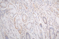 FLT1 Recombinant Monoclonal Antibody – Figure 1 of 1
