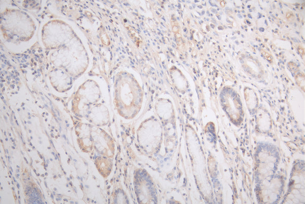 FLT1 Recombinant Monoclonal Antibody – Figure 1 of 1