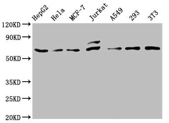 Western Blot
Positive WB detected in: HepG2 whole cell lysate, Hela whole cell lysate, MCF-7 whole cell lysate, Jurkat whole cell lysate, A549 whole cell lysate, 293 whole cell lysate, NIH/3T3 whole cell lysate
All lanes: c-FOS antibody at 0.81μg/ml
Secondary
Goat polyclonal to rabbit IgG at 1/50000 dilution
Predicted band size: 41, 29, 37 KDa
Observed band size: 62 KDa