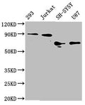 Western Blot
Positive WB detected in: 293 whole cell lysate, Jurkat whole cell lysate, SH-SY5Y whole cell lysate, U87 whole cell lysate
All lanes: FOXO3A antibody at 1.8μg/ml
Secondary
Goat polyclonal to rabbit IgG at 1/50000 dilution
Predicted band size: 72, 49 KDa
Observed band size: 72-90 KDa