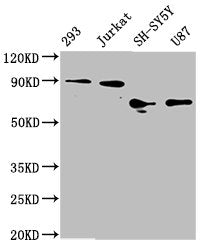 Western Blot
Positive WB detected in: 293 whole cell lysate, Jurkat whole cell lysate, SH-SY5Y whole cell lysate, U87 whole cell lysate
All lanes: FOXO3A antibody at 1.8μg/ml
Secondary
Goat polyclonal to rabbit IgG at 1/50000 dilution
Predicted band size: 72, 49 KDa
Observed band size: 72-90 KDa