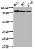 Western Blot
Positive WB detected in Hela whole cell lysate,  293 whole cell lysate, A549 whole cell lysate
All lanes Phospho-FOXO3 antibody at 0.96μg/ml
Secondary
Goat polyclonal to rabbit IgG at 1/50000 dilution
Predicted band size: 97 KDa
Observed band size: 97 KDa