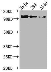Western Blot
Positive WB detected in Hela whole cell lysate,  293 whole cell lysate, A549 whole cell lysate
All lanes Phospho-FOXO3 antibody at 0.96μg/ml
Secondary
Goat polyclonal to rabbit IgG at 1/50000 dilution
Predicted band size: 97 KDa
Observed band size: 97 KDa