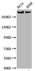 Phospho-MTOR (S2448) Antibody – Figure 1 of 3