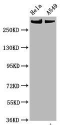 Phospho-MTOR (S2448) Antibody – Figure 1 of 3