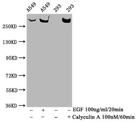 Phospho-MTOR (S2481) Antibody – Figure 1 of 2
