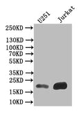 Western Blot
Positive WB detected in: U251 whole cell lysate,JK whole cell lysate
All lanes: FTH1 antibody at 1:500
Secondary
Goat polyclonal to mouse IgG at 1/50000 dilution
Predicted band size: 22 kDa
Observed band size: 22 kDa