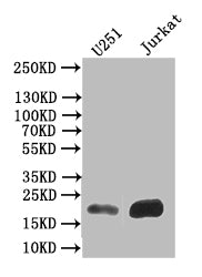 Western Blot
Positive WB detected in: U251 whole cell lysate,JK whole cell lysate
All lanes: FTH1 antibody at 1:500
Secondary
Goat polyclonal to mouse IgG at 1/50000 dilution
Predicted band size: 22 kDa
Observed band size: 22 kDa