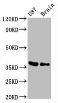 Western Blot
Positive WB detected in U87 whole cell lysate,  Mouse brain tissue
All lanes GAPDH antibody at 0.31μg/ml
Secondary
Goat polyclonal to rabbit IgG at 1/50000 dilution
Predicted band size: 36 KDa
Observed band size: 36 KDa