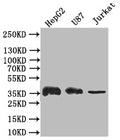 Western Blot
Positive WB detected in: HepG2 whole cell lysate,U87 whole cell lysate,JK whole cell lysate
All lanes: GAPDH antibody at 1:500
Secondary
Goat polyclonal to rabbit IgG at 1/50000 dilution
Predicted band size: 36 kDa
Observed band size: 36 kDa