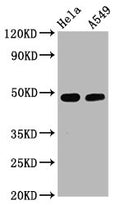 Western Blot
Positive WB detected in Hela whole cell lysate,A549 whole cell lysate
All lanes Phospho-GATA3 antibody at 2.5μg/ml
Secondary
Goat polyclonal to rabbit IgG at 1/50000 dilution
Predicted band size: 48 KDa
Observed band size: 48 KDa