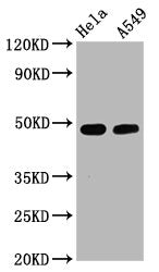 Western Blot
Positive WB detected in Hela whole cell lysate,A549 whole cell lysate
All lanes Phospho-GATA3 antibody at 2.5μg/ml
Secondary
Goat polyclonal to rabbit IgG at 1/50000 dilution
Predicted band size: 48 KDa
Observed band size: 48 KDa