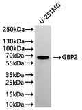 Western Blot
Positive WB detected in: U-251MG whole cell lysate(20µg) 
All lanes: GBP2 antibody at 1:1000
Secondary
Goat polyclonal to rabbit IgG at 1/40000 dilution
Predicted band size: 67 kDa
Observed band size: 67 kDa
Exposure time：2min