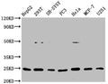 Western Blot
Positive WB detected in: HepG2 whole cell lysate, 293T whole cell lysate, SH-SY5Y whole cell lysate, PC3 whole cell lysate, Hela whole cell lysate, MCF-7 whole cell lysate, U251 whole cell lysate
All lanes: GDNF antibody at 1μg/ml
Secondary
Goat polyclonal to rabbit IgG at 1/50000 dilution
Predicted band size: 24, 21, 26, 23, 19 KDa
Observed band size: 24 KDa